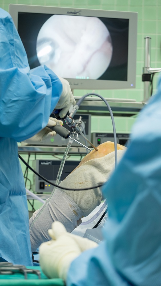 What is Arthroscopic Surgery?