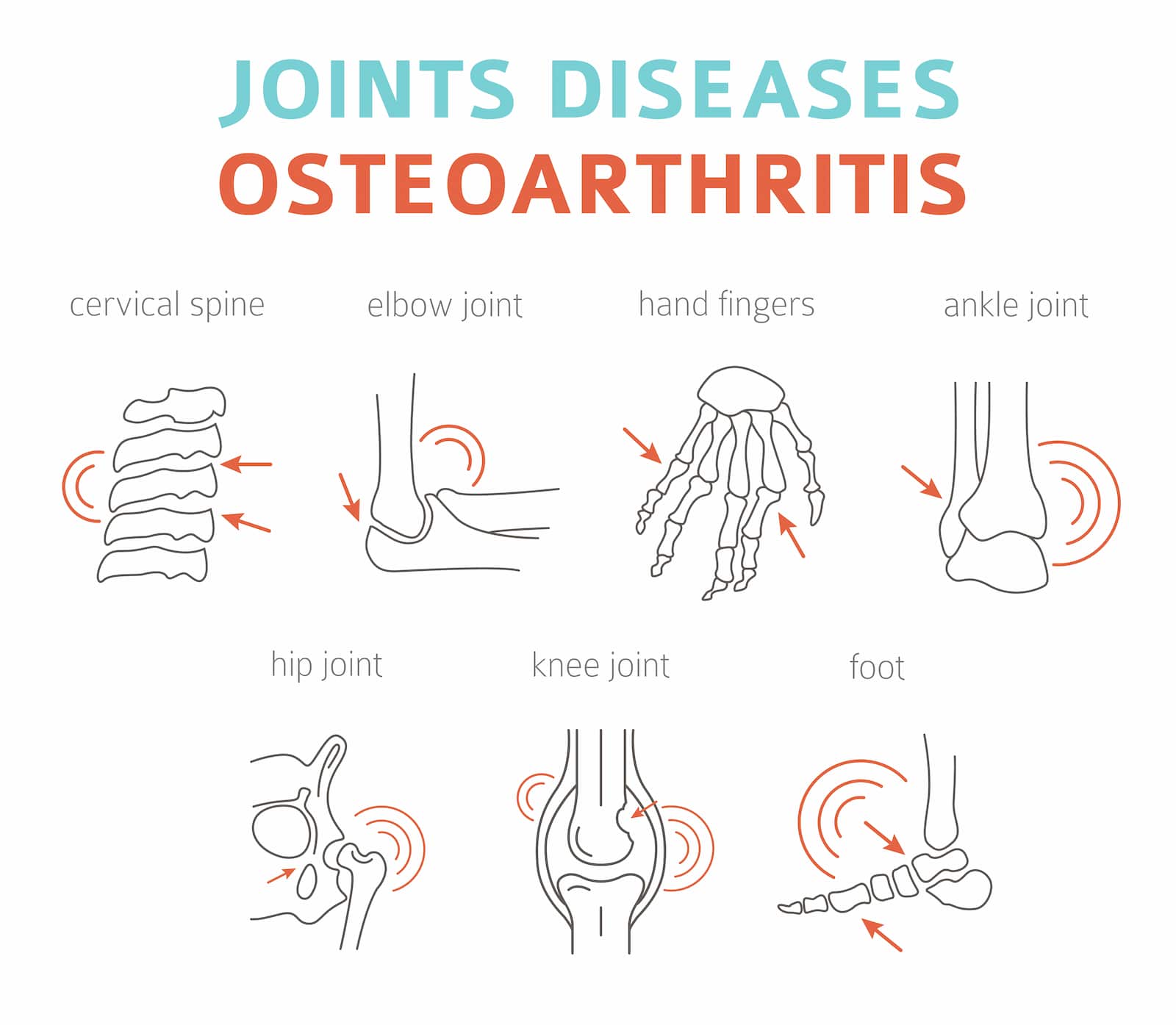 Osteoarthritis 3