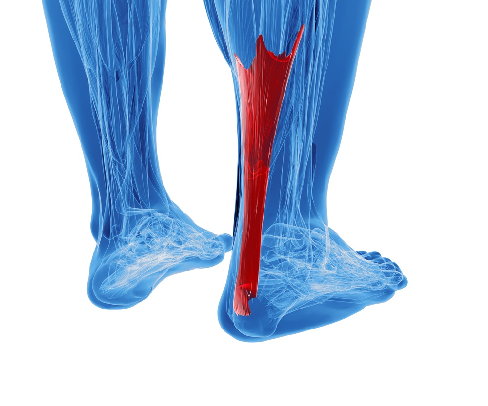 RACGP - The Achilles tendon