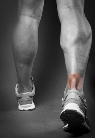 achilles-tendonitis-pain-inflammation