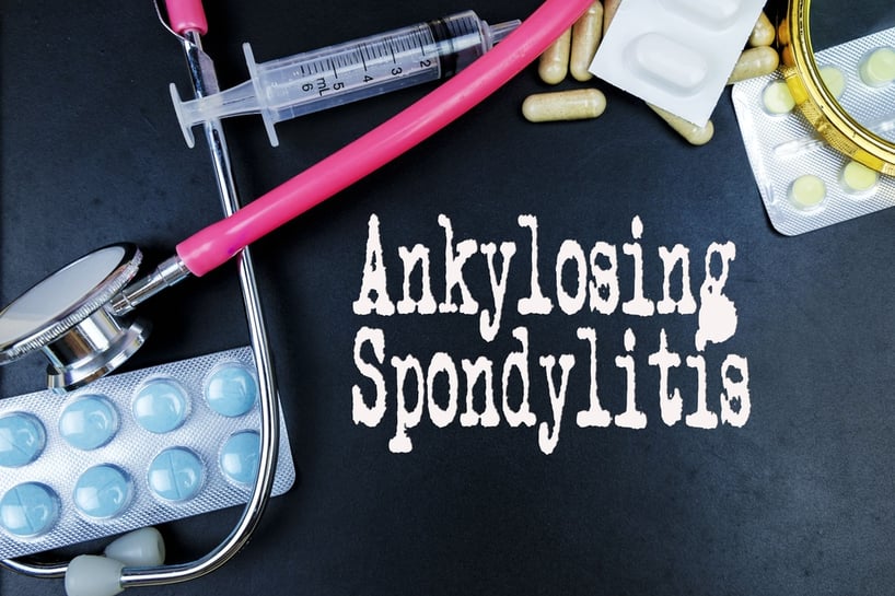 ankylosing spondylitis signs symptoms and risk factors explained