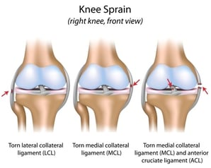 knee sprain sites