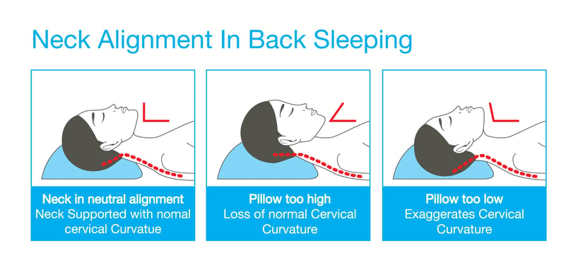 Natural head posture (A) and comfortable maximum forward head