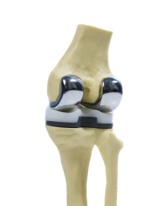 what is a knee replacement