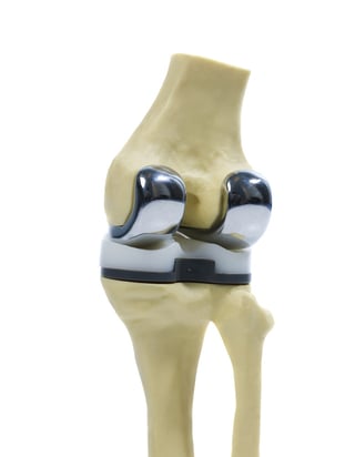 arthritis-knee-replacement