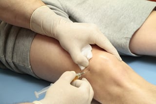 prp knee injection procedure costs