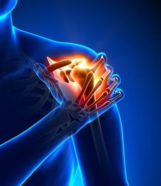 shoulder-pain-arthroscopic-surgery