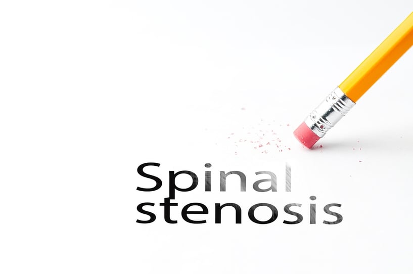 spinal stenosis.jpg