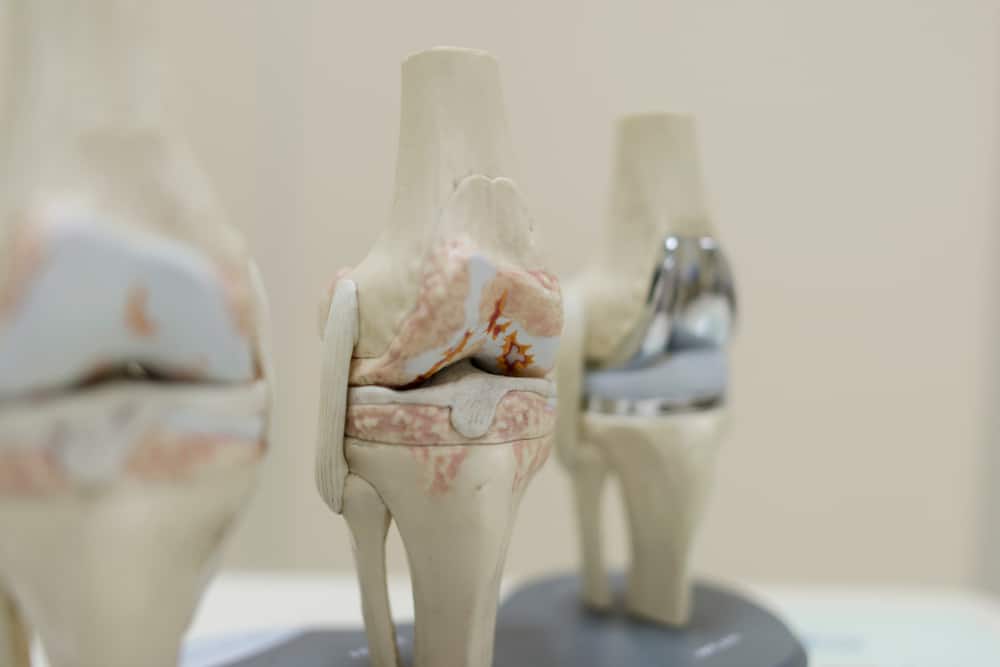Total Knee Replacement | Orthopedic Surgeon | Corpus Christi, Texas Total Knee Replacement | Orthopedic Surgeon | Corpus Christi, Texas