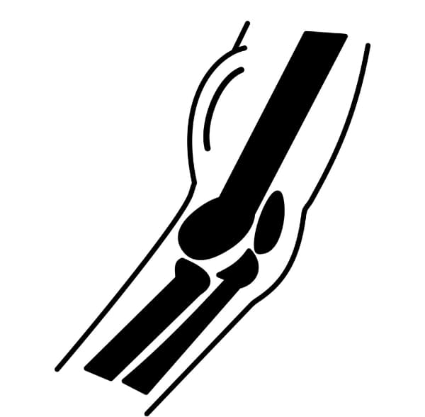 biceps tendon