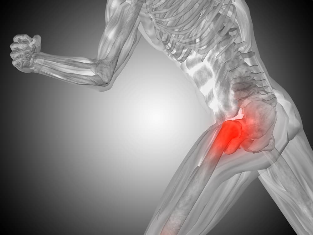 hip pain