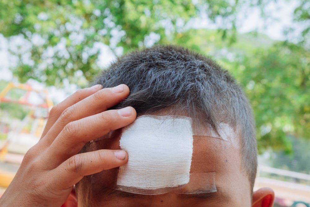 child-head-injury-bandage
