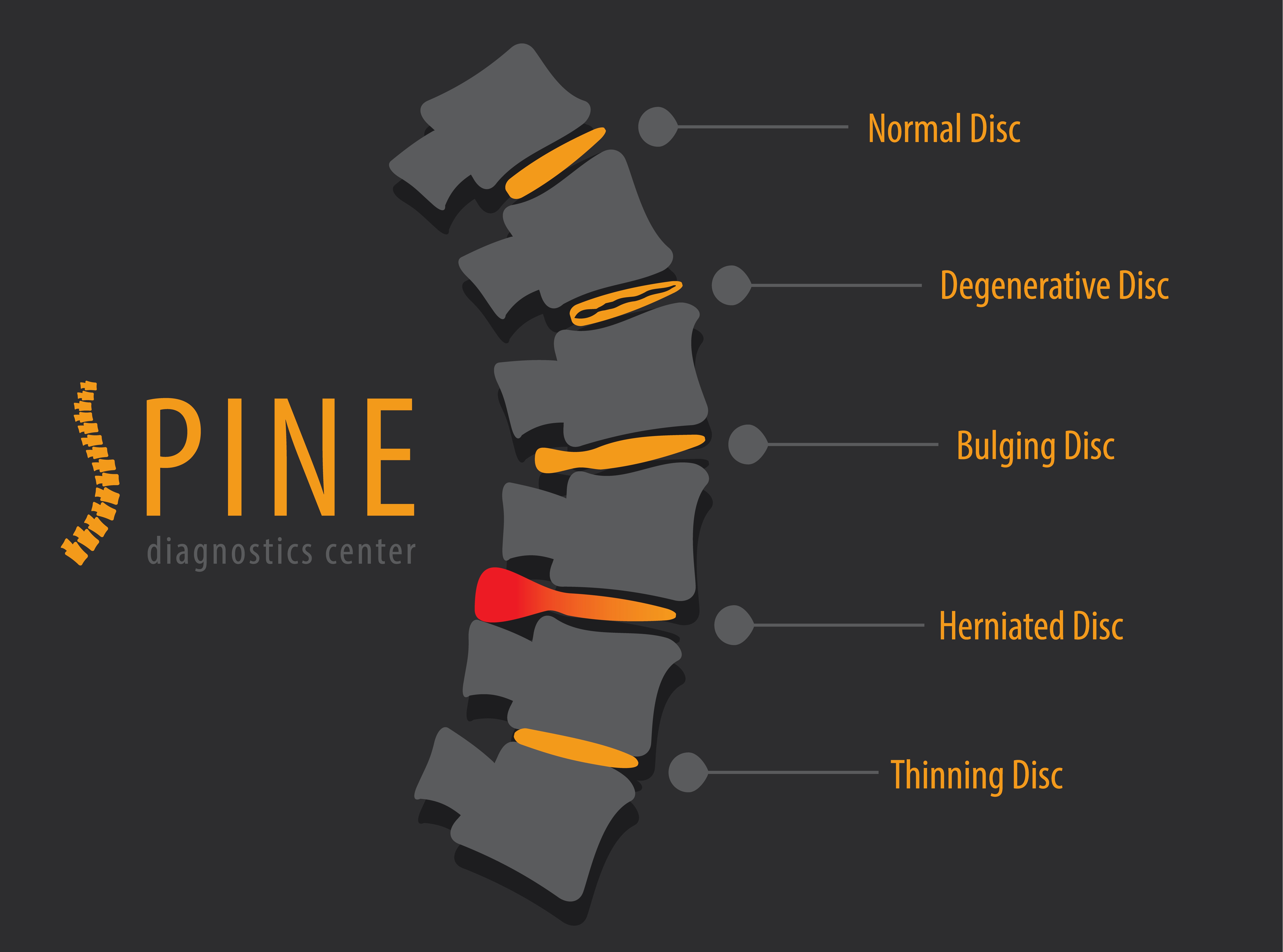 herniated disc treatment options